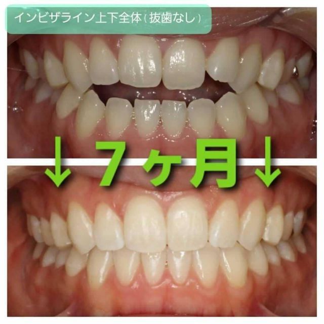 公式 東京八重洲キュア矯正歯科 舌側矯正とマウスピース型矯正専門