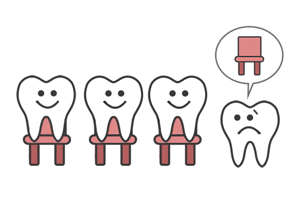 矯正の抜歯イメージ